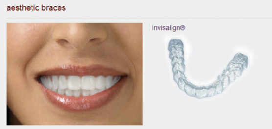 A Patient’s Guide to Invisalign