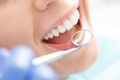 Answers to Patient Questions About Damon Braces