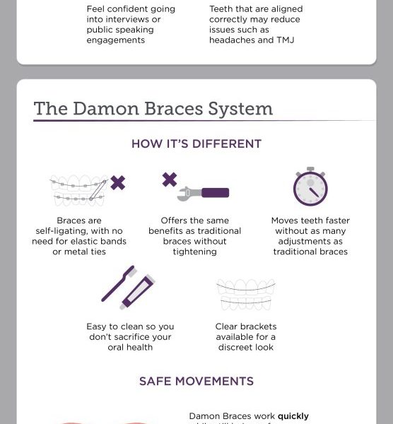 All about Damon Braces [INFOGRAPHIC]