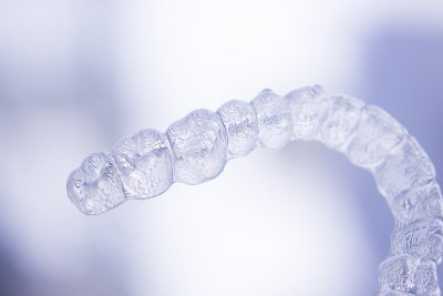 STEPS TO FOLLOW WHEN YOU’RE CONSIDERING INVISALIGN TREATMENT